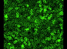 Tcell-crowd1.jpg